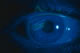 Corneal abrasion