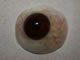 Artificial eye